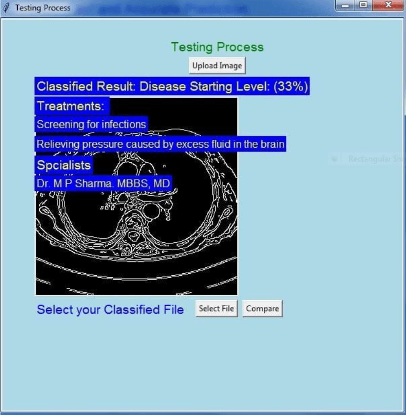 Liver Cancer Detection with Deep Learning